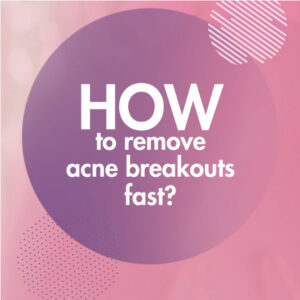 Breaking those bad habits you have for your breakouts can be tough. Leave it to us to help you with it instead.