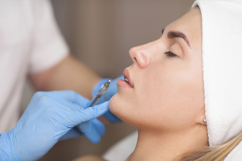 Dermal Fillers