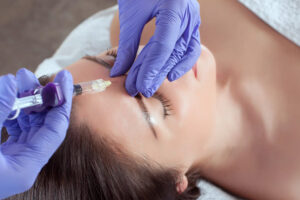 Dermal Fillers