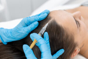FUE hair transplantation