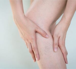 Leg and Facial Veins