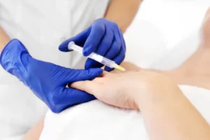 Hand Rejuvenation
