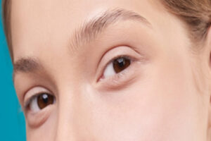 Laser SpotClear Program