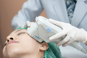 Ultherapy treatment