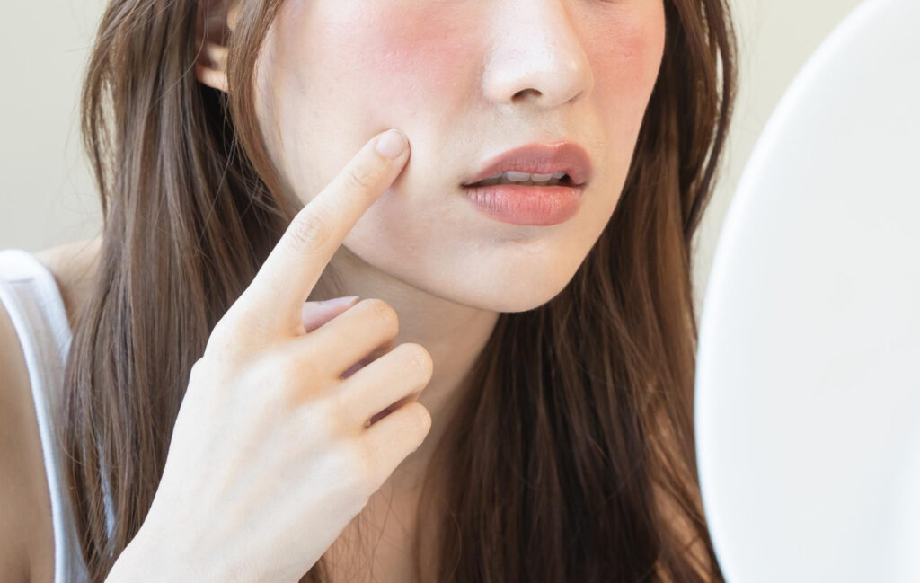 Close-up of a woman touching a red cheek while looking into a mirror, assessing her skin