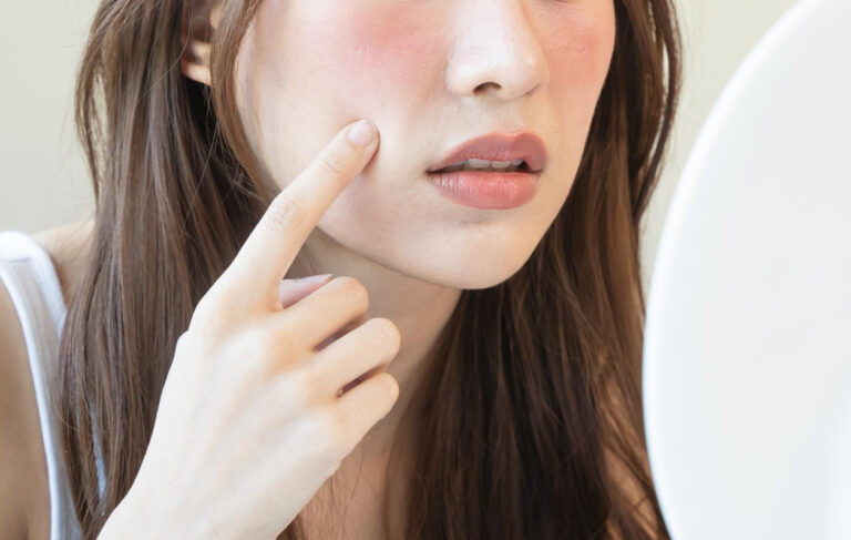 Close-up of a woman touching a red cheek while looking into a mirror, assessing her skin