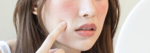 Redness & Sensitive Skin