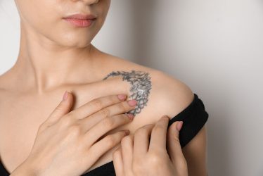 Tattoo Removal
