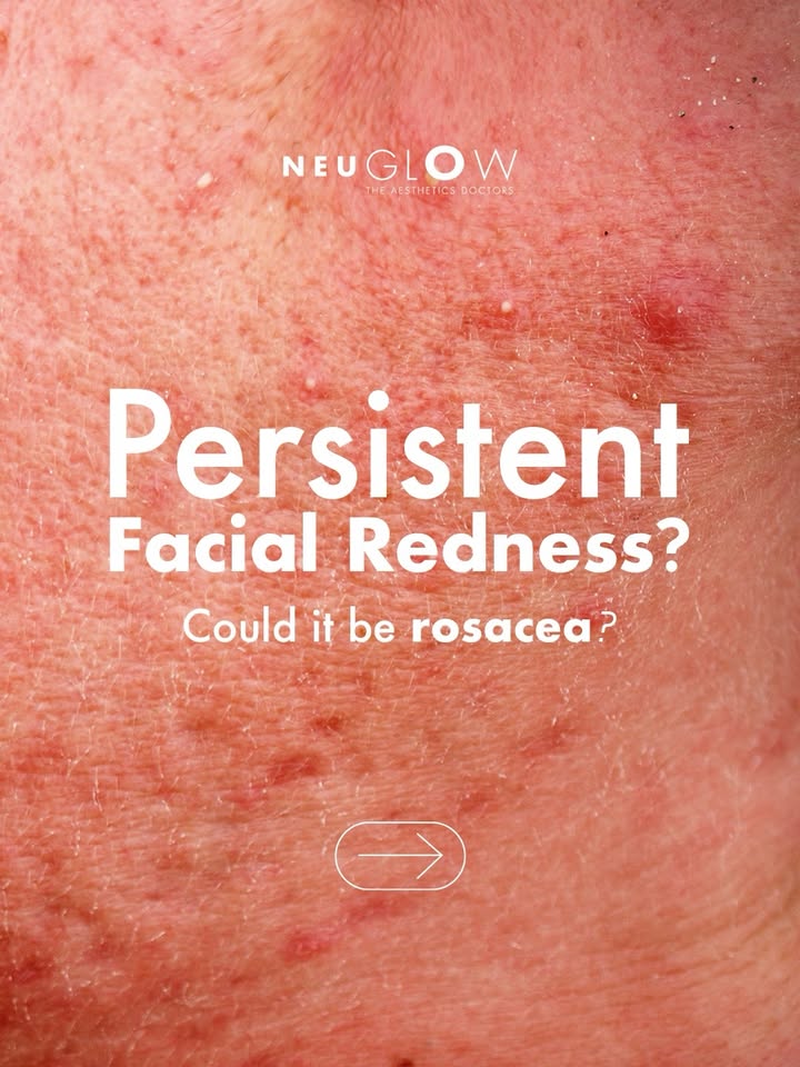 NeuGlow The Aesthetics Doctors